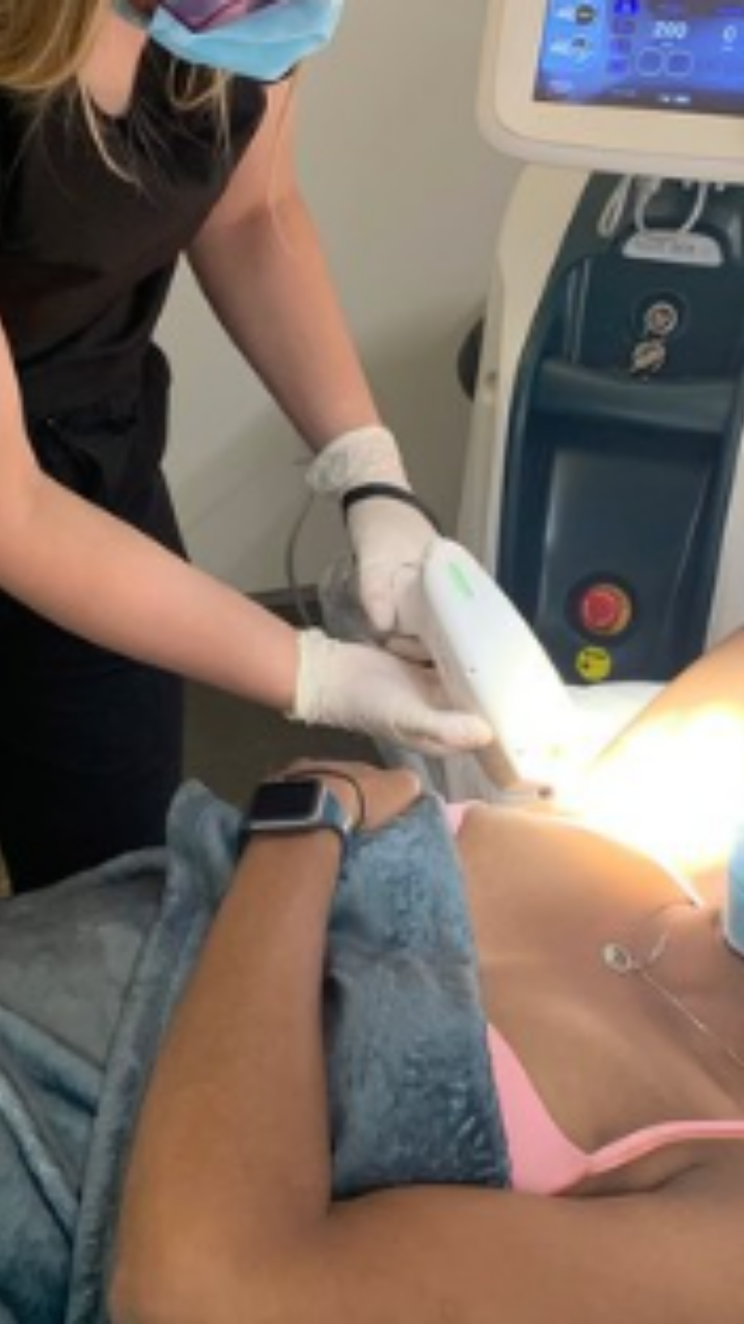 Bare 808 treatment post 2