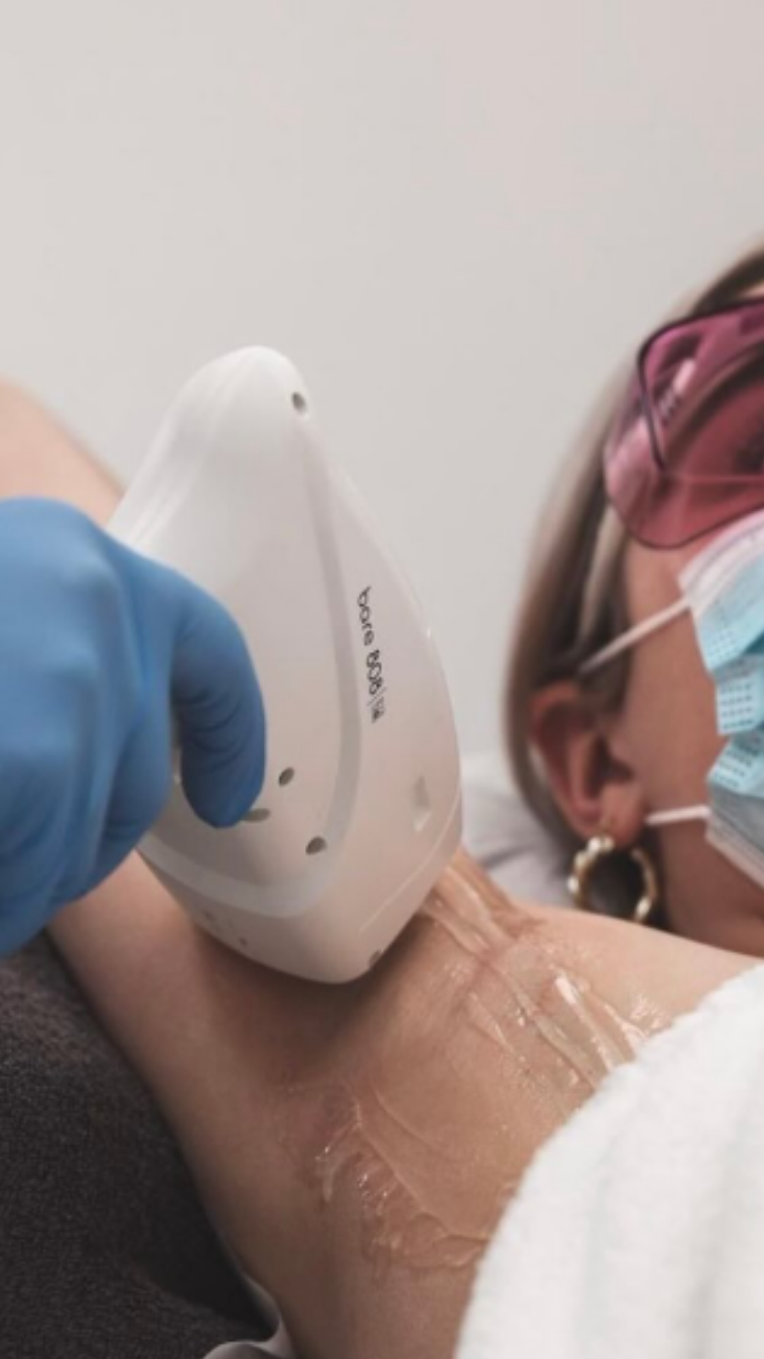 Bare 808 treatment post 5