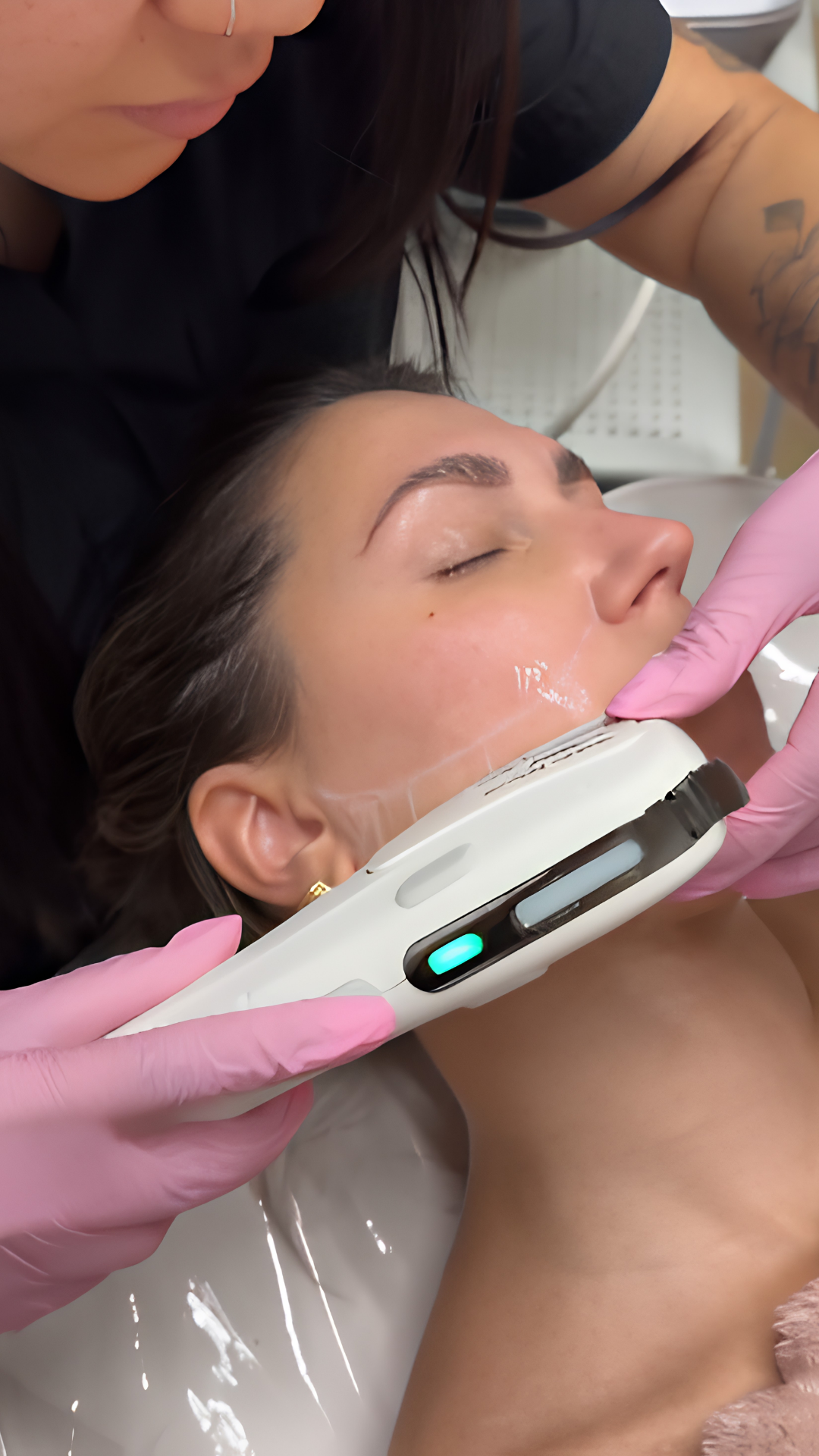 Prolift Dual treatment