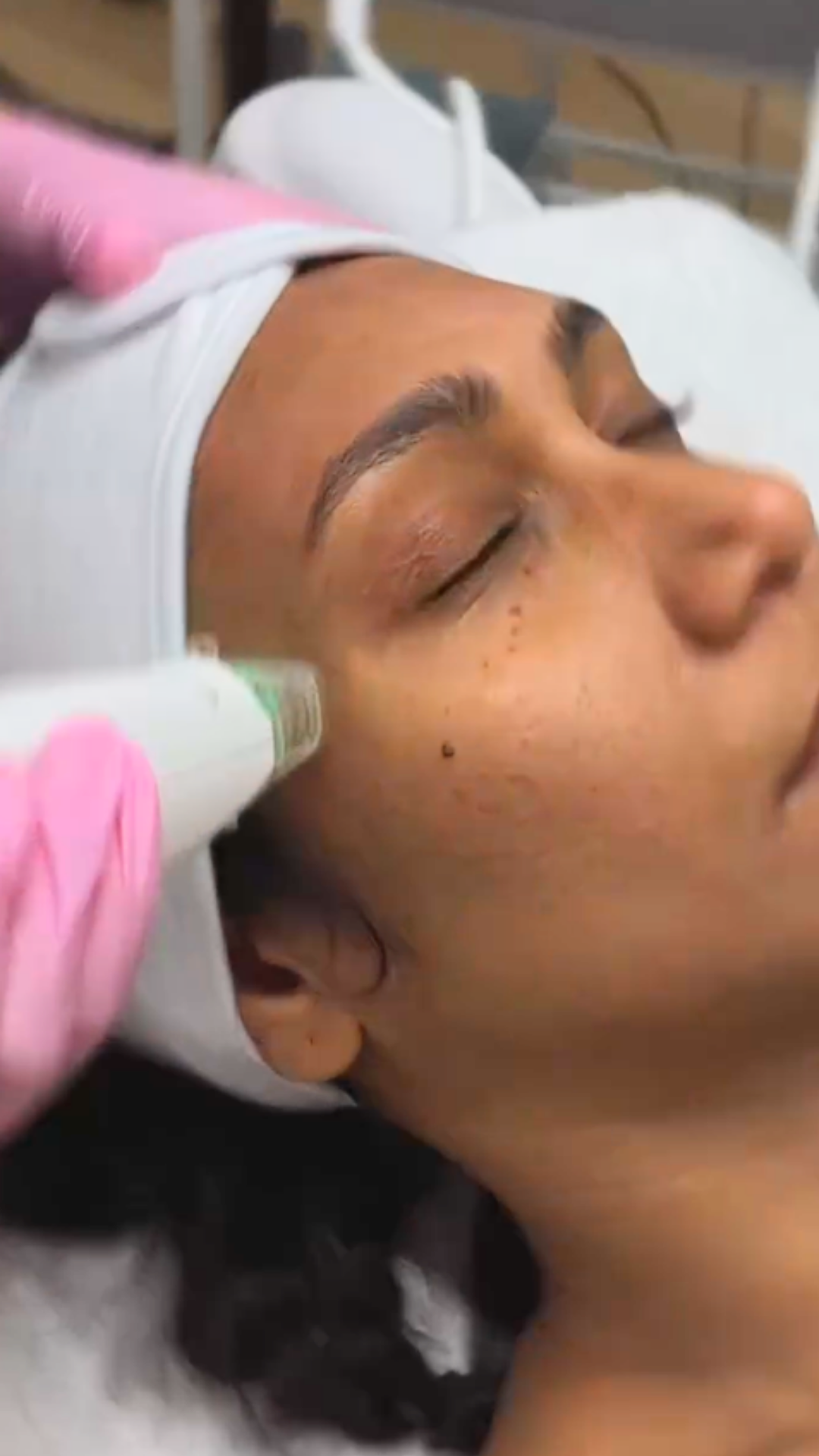 Prolift Dual treatment