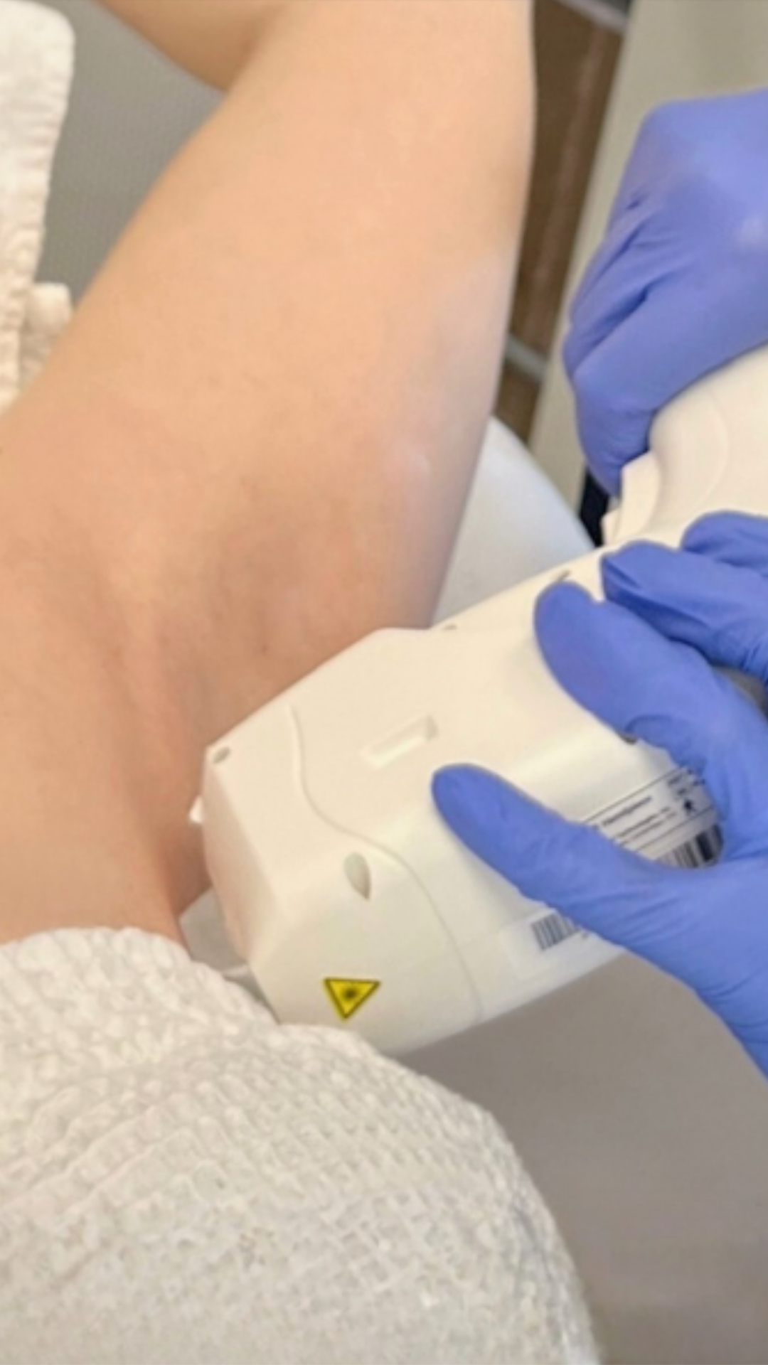 Bare 808 treatment post 1